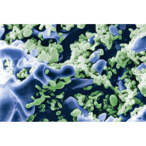 Sera filtrační materiál siporax vč. přípravku Filter Biostart zdarma